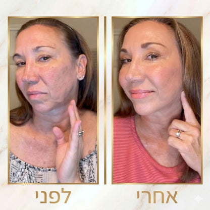 VERDO Dolphin-Lift™ | מכשיר ביוטי-טק ביתי לפיסול ומתיחת קו הלסת סנטר וצוואר